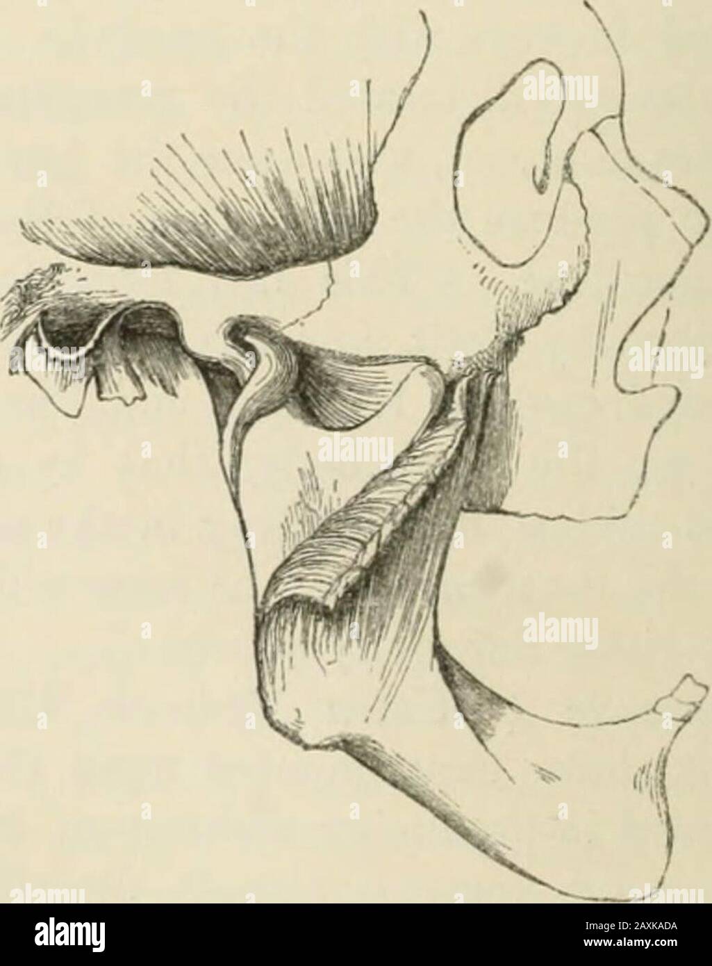 Injuries and diseases of the jaws . e temporal muscle, and are quite below, andscarcely ever touch the malar bone. The capsular ligamentis tense, but not ruptured; the external lateral ligament is jltense, and passes from behind forwards instead of from be-fore backwards; the internal lateral and stylo-maxillaryligaments are stretched, and this is increased by raising thechin. The inter-articular fibro-cartilages are attached toand follow the motions of tlie condyles. According toMaisonneuve, the temporal muscles are only stretched; butWeber says that some of the fibres are usually torn oflP t Stock Photo