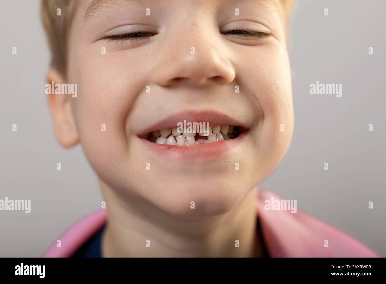 5 year old boy shows first fallen milk tooth. smiling fiveyearold boy