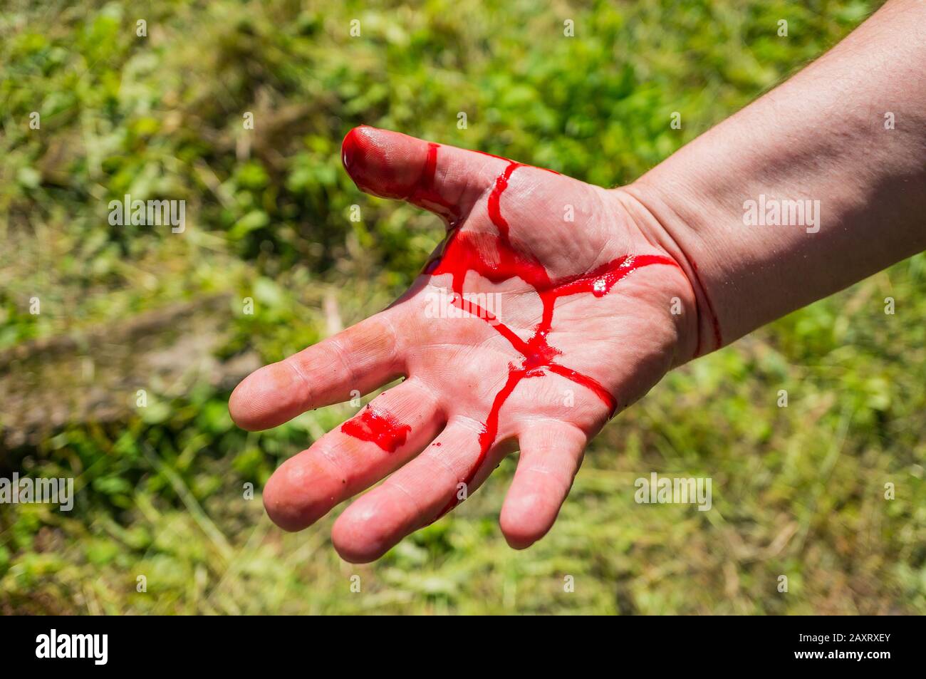 Bloody Hand Injury High Resolution Stock Photography And Images Alamy