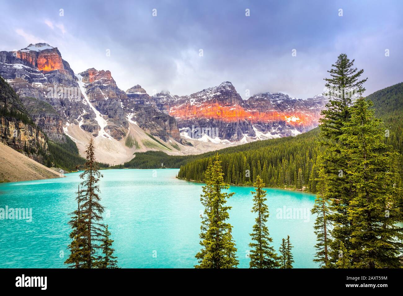 Moraine Lake with nicely illuminaten mountains in the back, Alberta, Canada Stock Photo