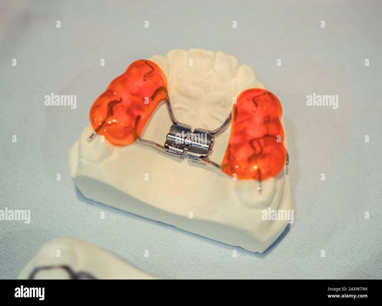 example of a bridge on an artificial human jaw close-up Stock Photo