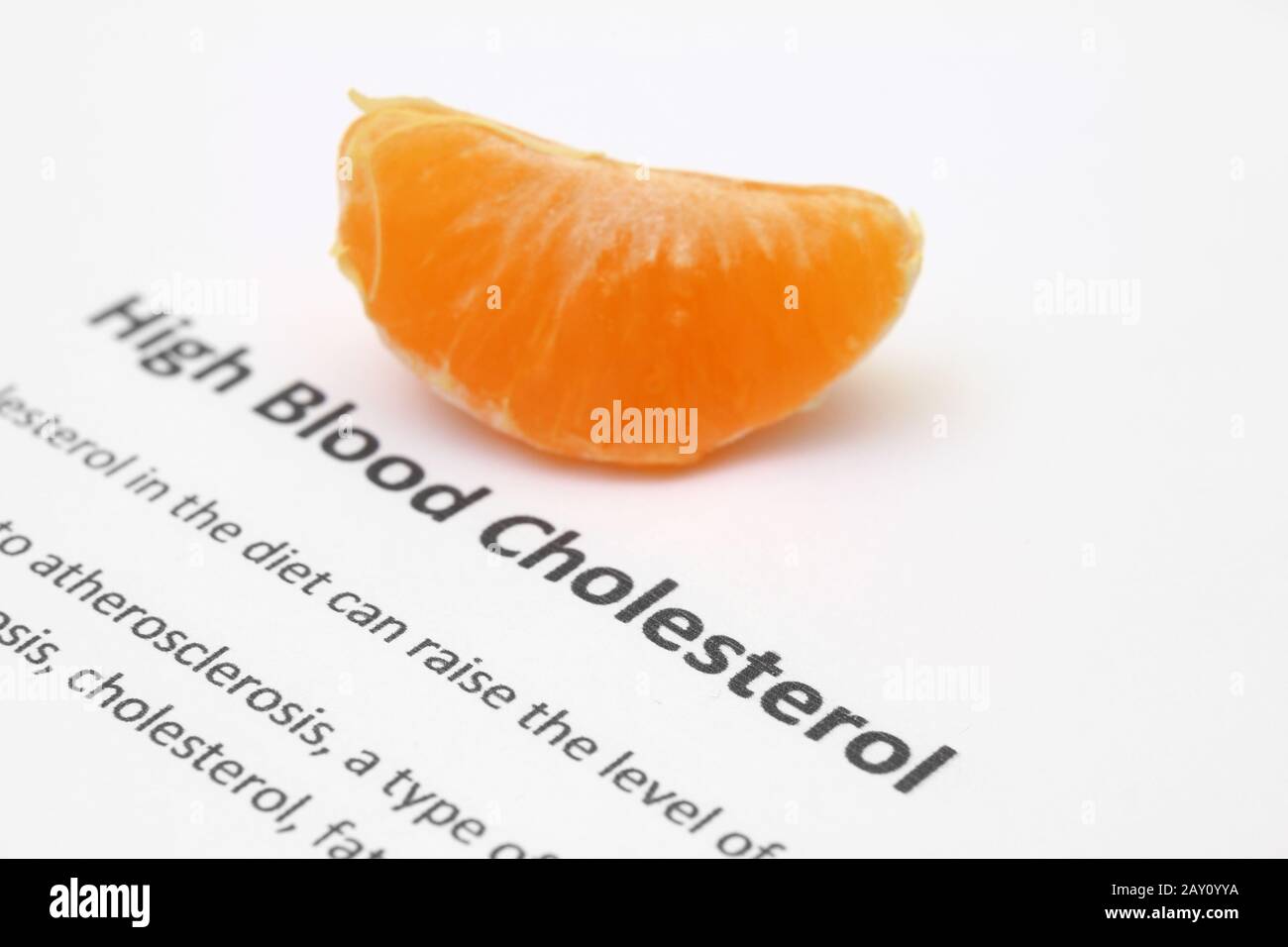 High cholesterol blood test hires stock photography and images Alamy