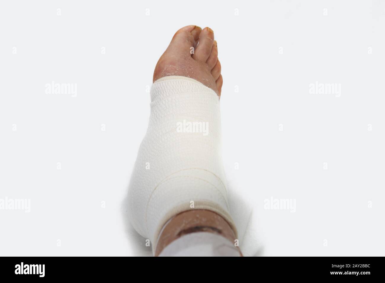 injury to the foot and bandage of gauze and bandages Stock Photo
