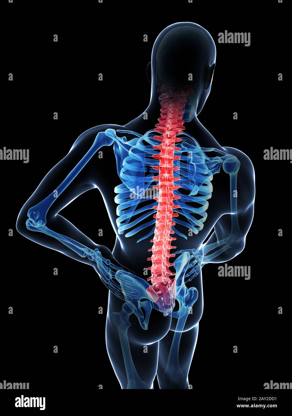 3d rendered illustration - backache Stock Photo - Alamy