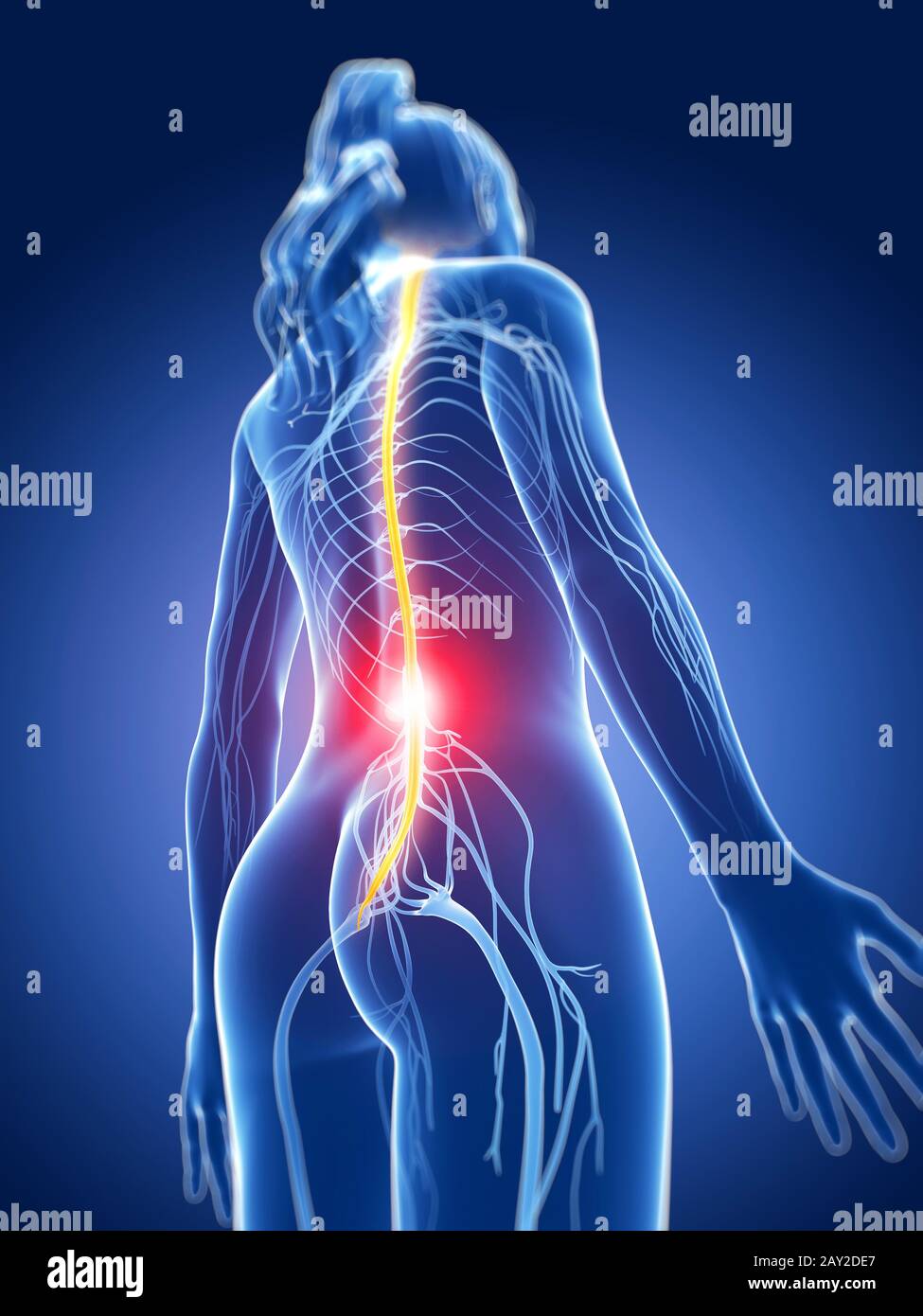 3d rendered medical illustration - painful nerves Stock Photo - Alamy