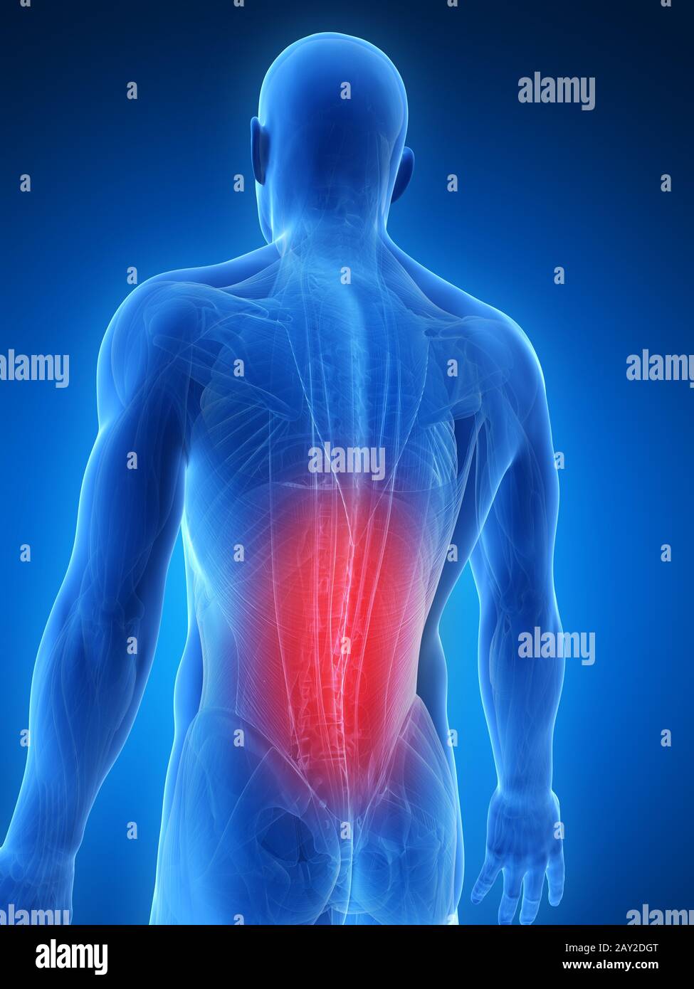 3d rendered illustration painful back muscles Stock Photo Alamy