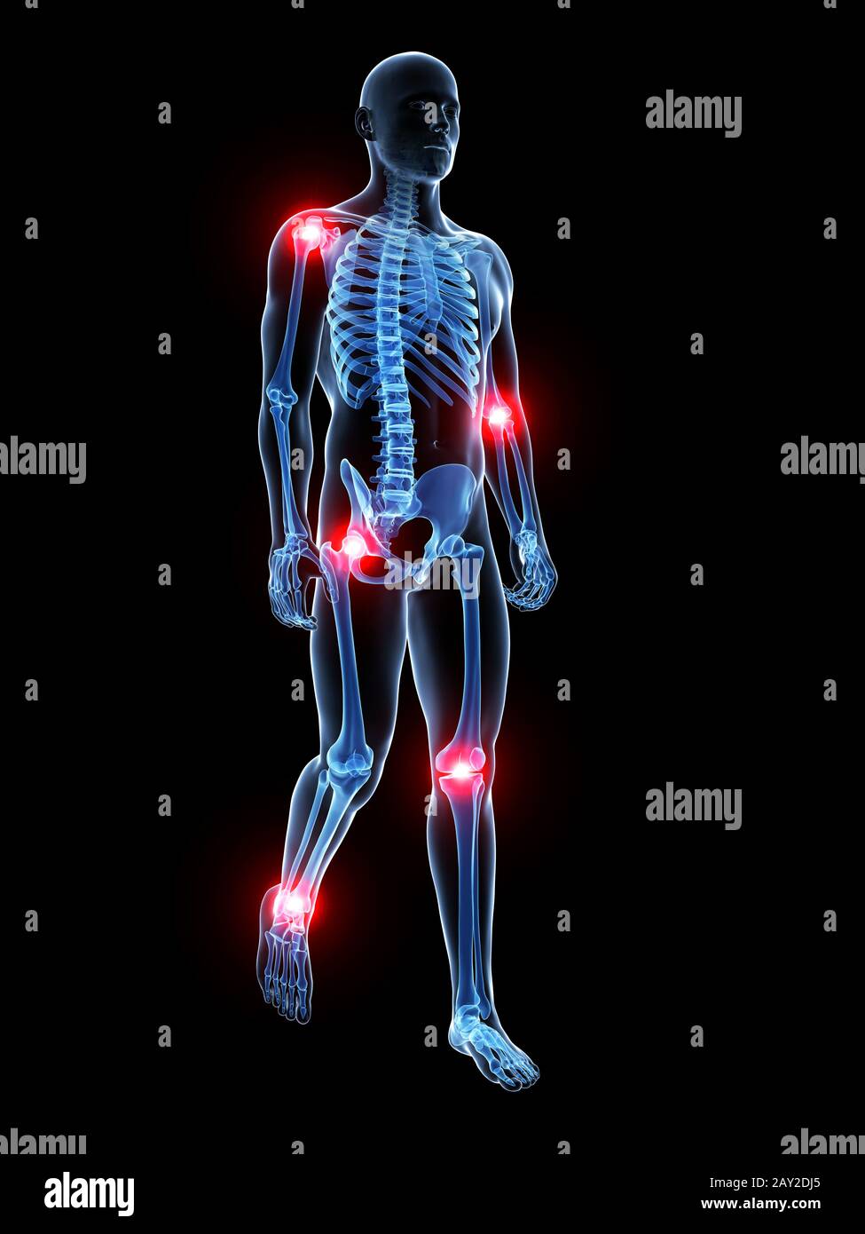 3d rendered medical illustration - painful joints Stock Photo - Alamy