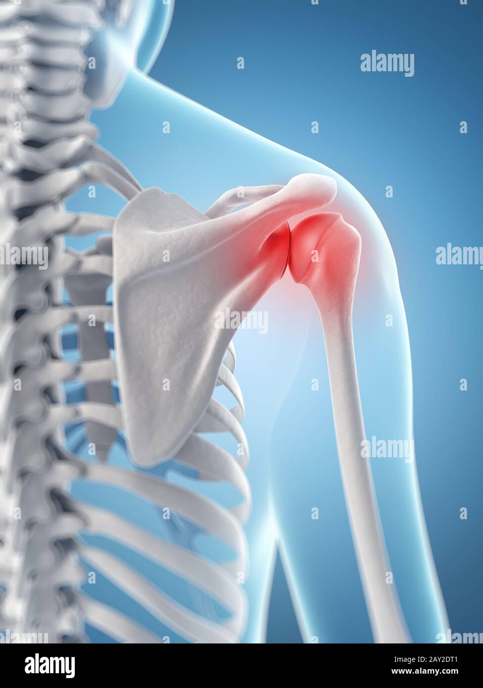 inflamed shoulder joint Stock Photo Alamy