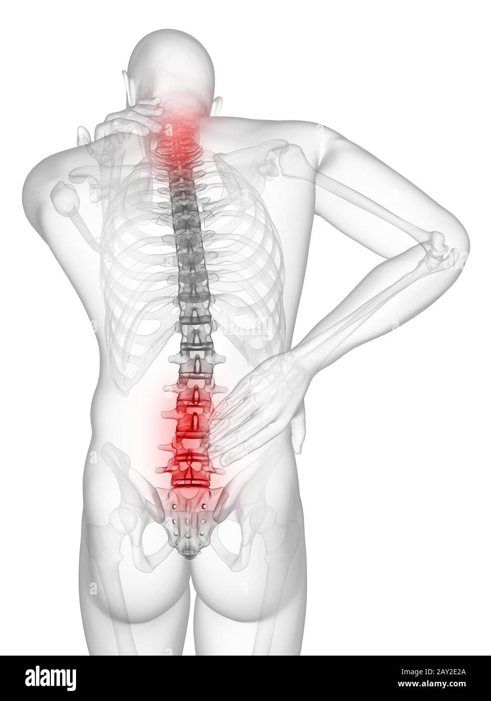 3d rendered illustration of a man having a painful back and neck Stock Photo