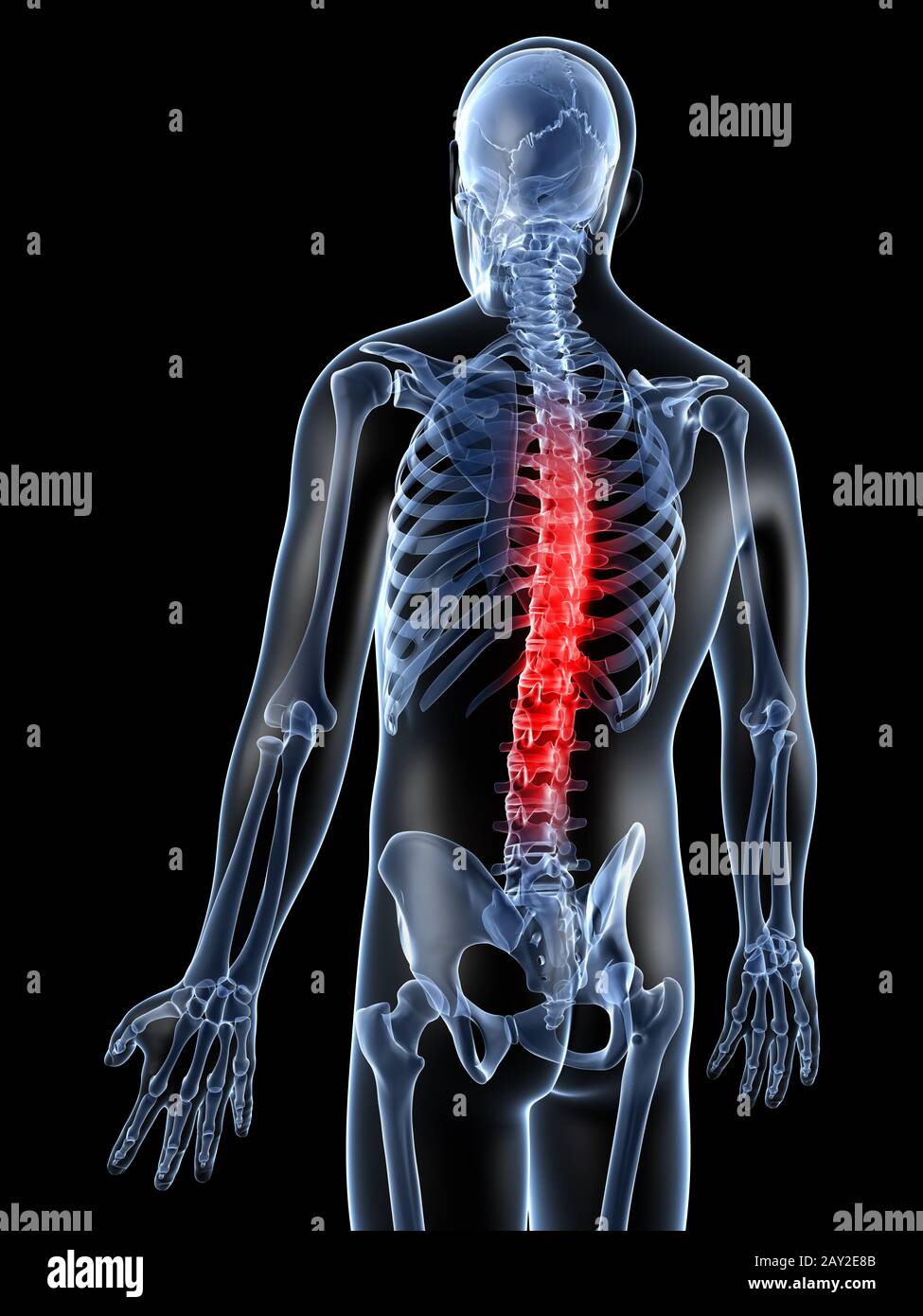 3d rendered illustration of a painful back Stock Photo - Alamy
