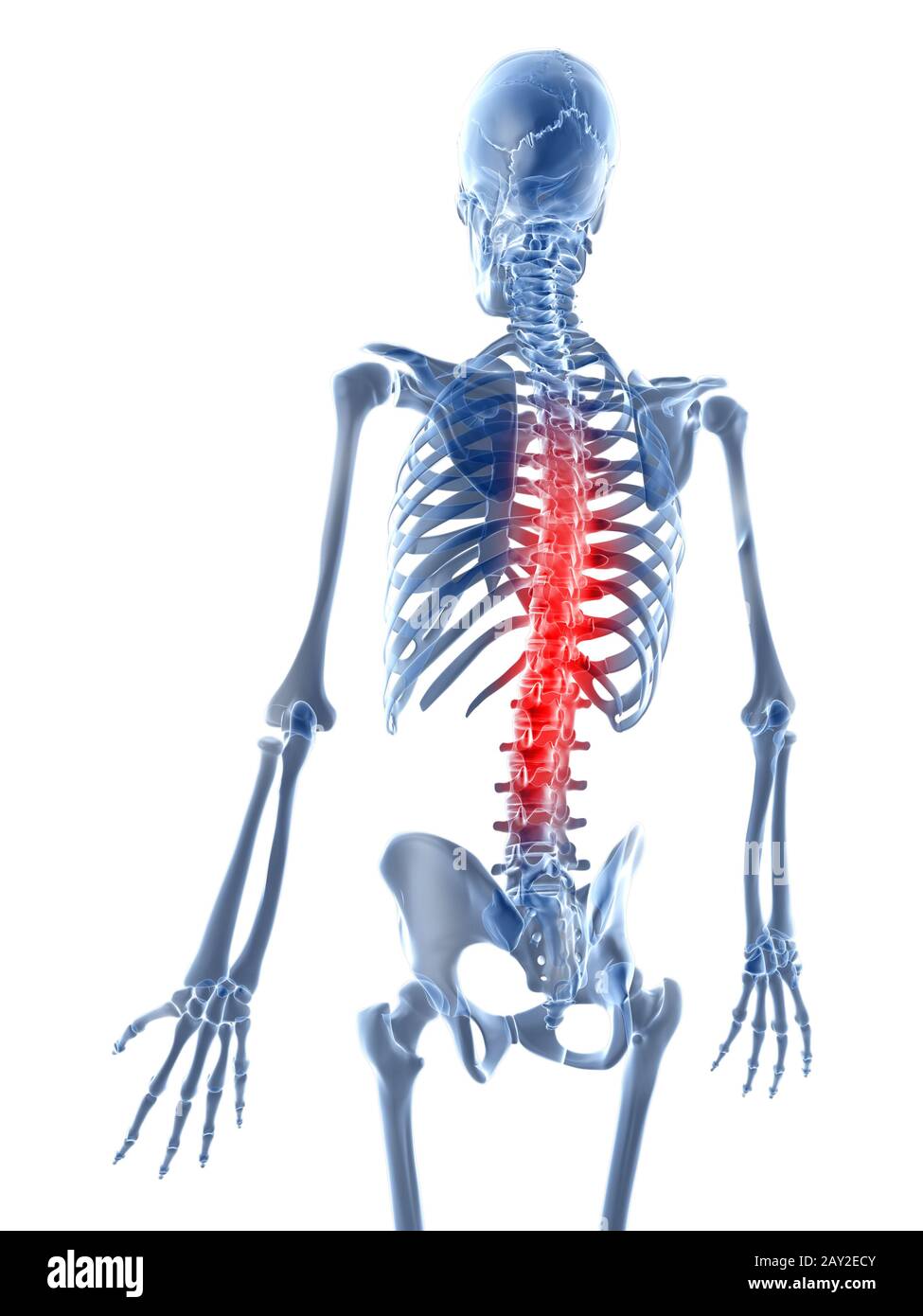 3d rendered illustration of a painful back Stock Photo - Alamy