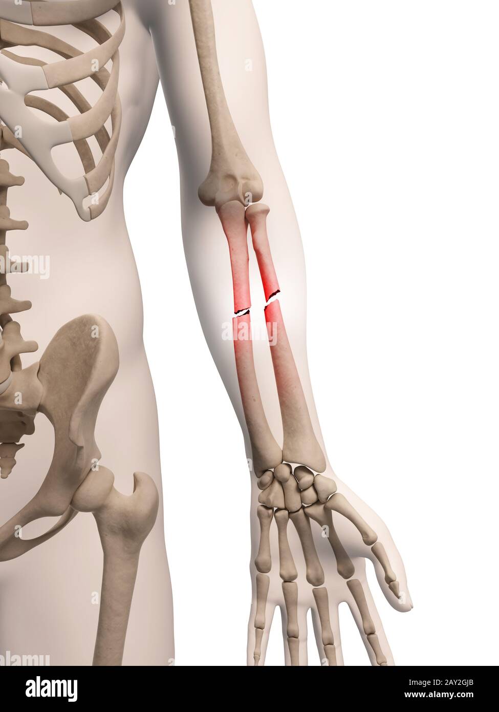 medical illustration of arm bone Stock Photo
