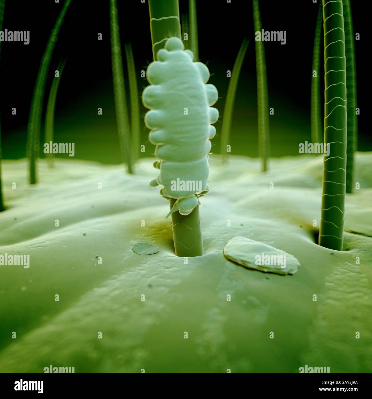 Head lice louse eggs hi-res stock photography and images - Alamy