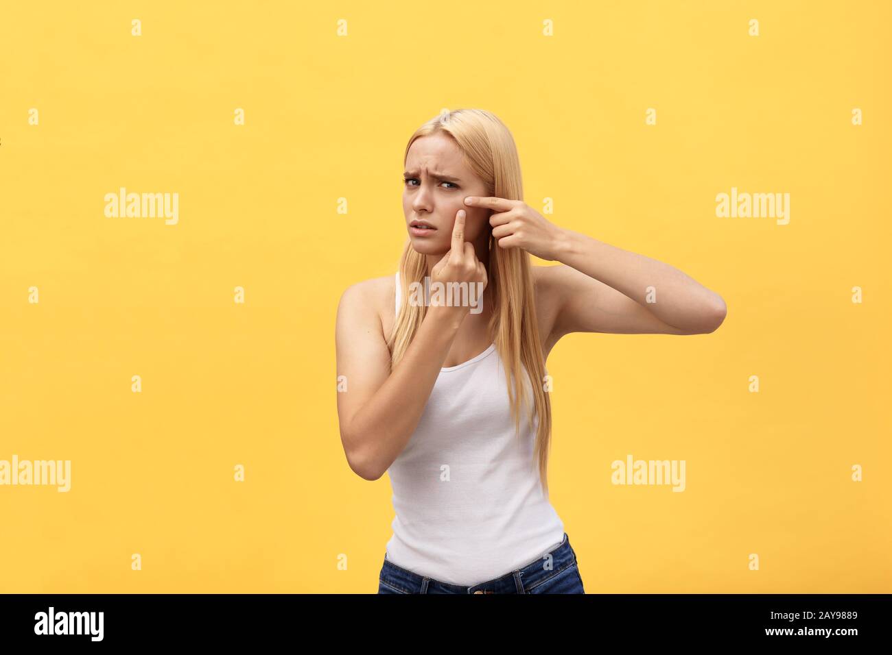 Close-up portrait of worried girl with acne problem, touching face, spa, therapy, treatment, isolated over yellow background Stock Photo