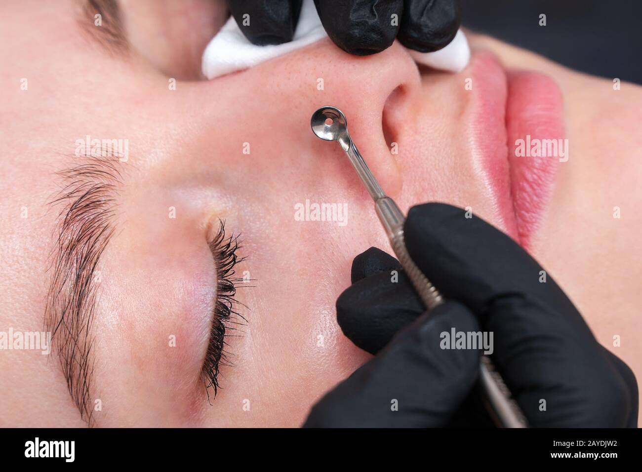 mechanical cleaning of the face around the nose patient spa salon using an extractor Stock Photo