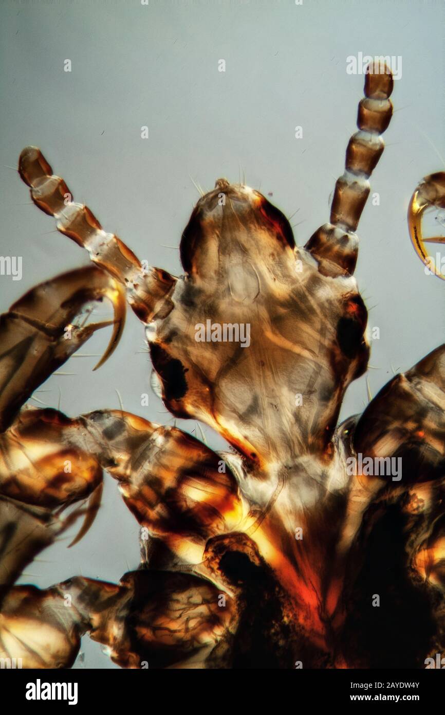 Head of the head louse with sucking mouth tools Stock Photo