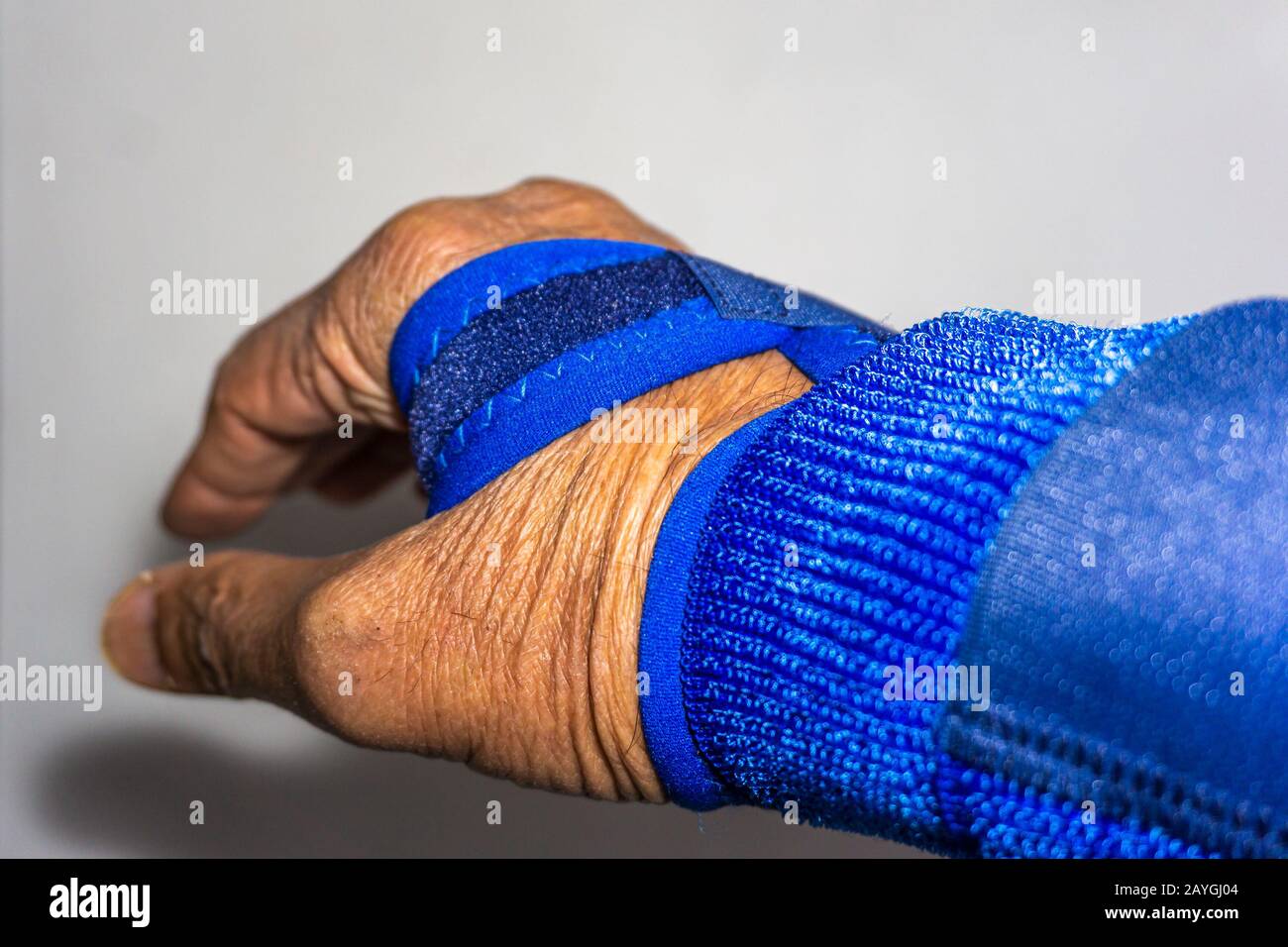 Wrist fracture hires stock photography and images Alamy