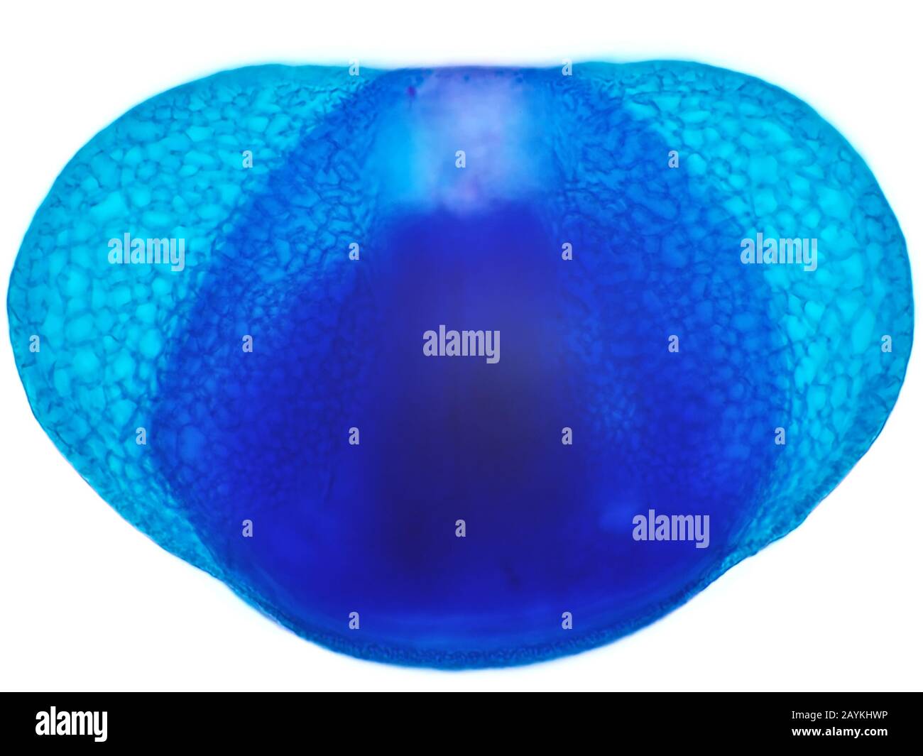 Conifer pollen grain under the microscope - stained with Toluidine Blue, using 100x oil microscope objective Stock Photo