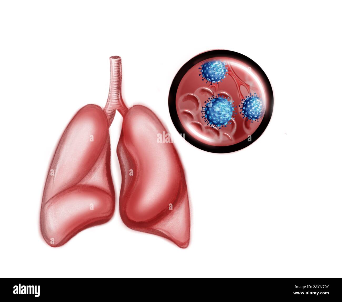 Illustration of the human lungs and coronavirus Stock Photo