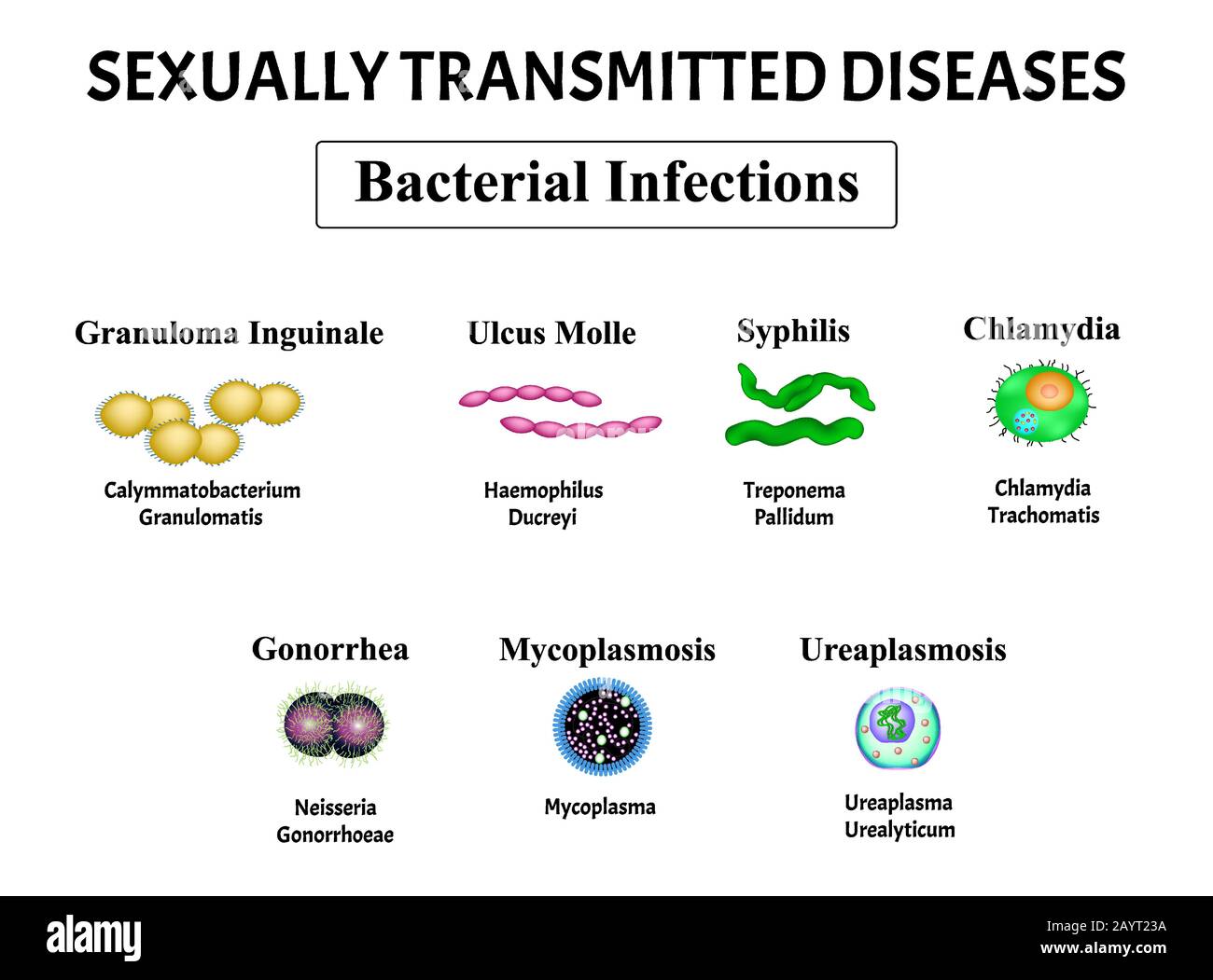Syphilis, spirochaete, Treponema, Gonococcus, Gonorrhea, Chlamydiosis, Chlamydia, Mycoplasma, Ureaplasma Bacterial infection set. Sexually transmitted Stock Vector