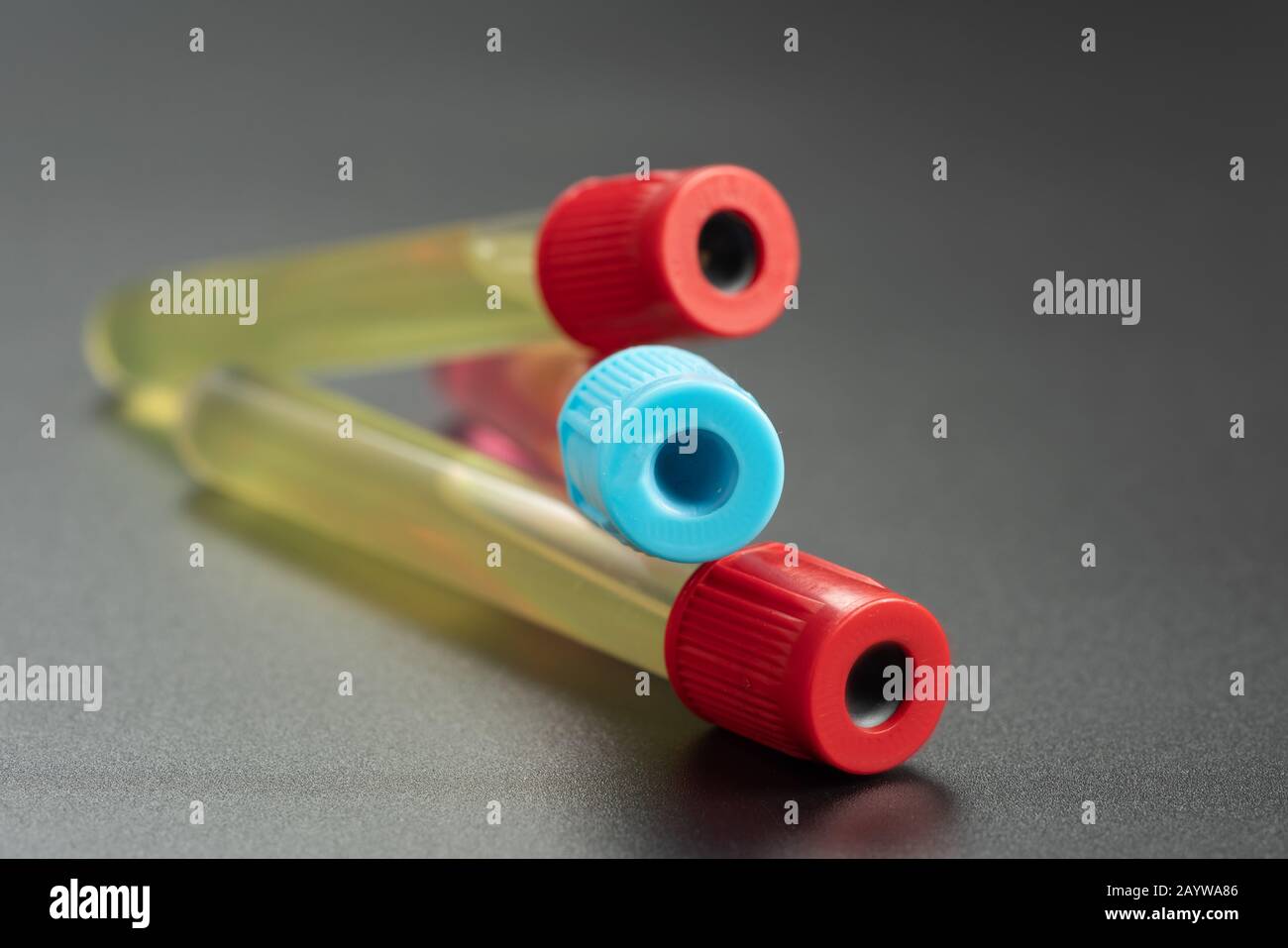 Test tubes with chemical samples in science laboratory Stock Photo - Alamy
