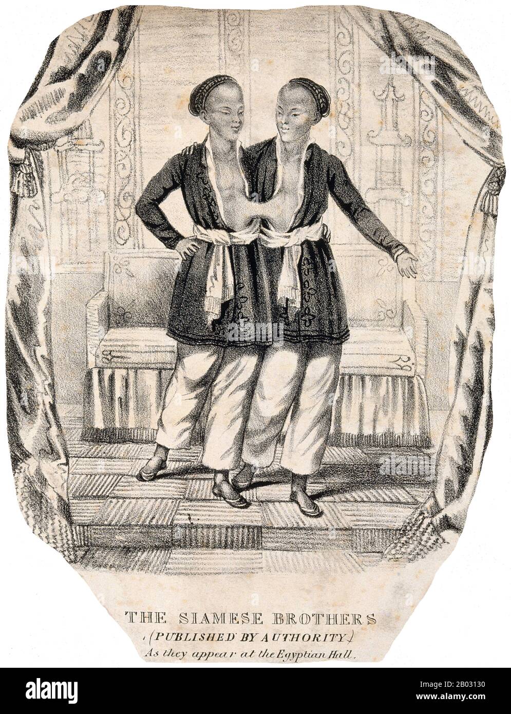 Chang and Eng Bunker (May 11, 1811 – January 17, 1874) were Thai-American conjoined twin brothers whose condition and birthplace became the basis for the term 'Siamese twins'.  The Bunker brothers were born on May 11, 1811, in the province of Samut Songkram, near Bangkok, in the Kingdom of Siam (today's Thailand). Their fisherman father was a Chinese Thai, while their mother was a Chinese Malaysian. Because of their Chinese heritage, they were known locally as the 'Chinese Twins'. The brothers were joined at the sternum by a small piece of cartilage, and though their livers were fused, they we Stock Photo