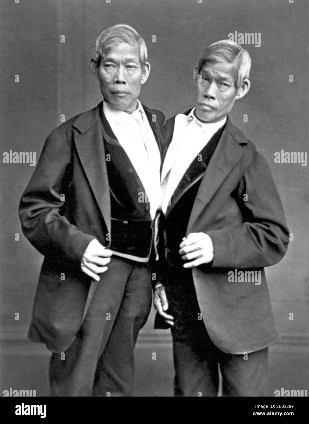 Chang and Eng Bunker (May 11, 1811 – January 17, 1874) were Thai-American conjoined twin brothers whose condition and birthplace became the basis for the term 'Siamese twins'.  The Bunker brothers were born on May 11, 1811, in the province of Samutsongkram, near Bangkok, in the Kingdom of Siam (today's Thailand). Their fisherman father was a Chinese Thai, while their mother was a Chinese Malaysian. Because of their Chinese heritage, they were known locally as the 'Chinese Twins'. The brothers were joined at the sternum by a small piece of cartilage, and though their livers were fused, they wer Stock Photo