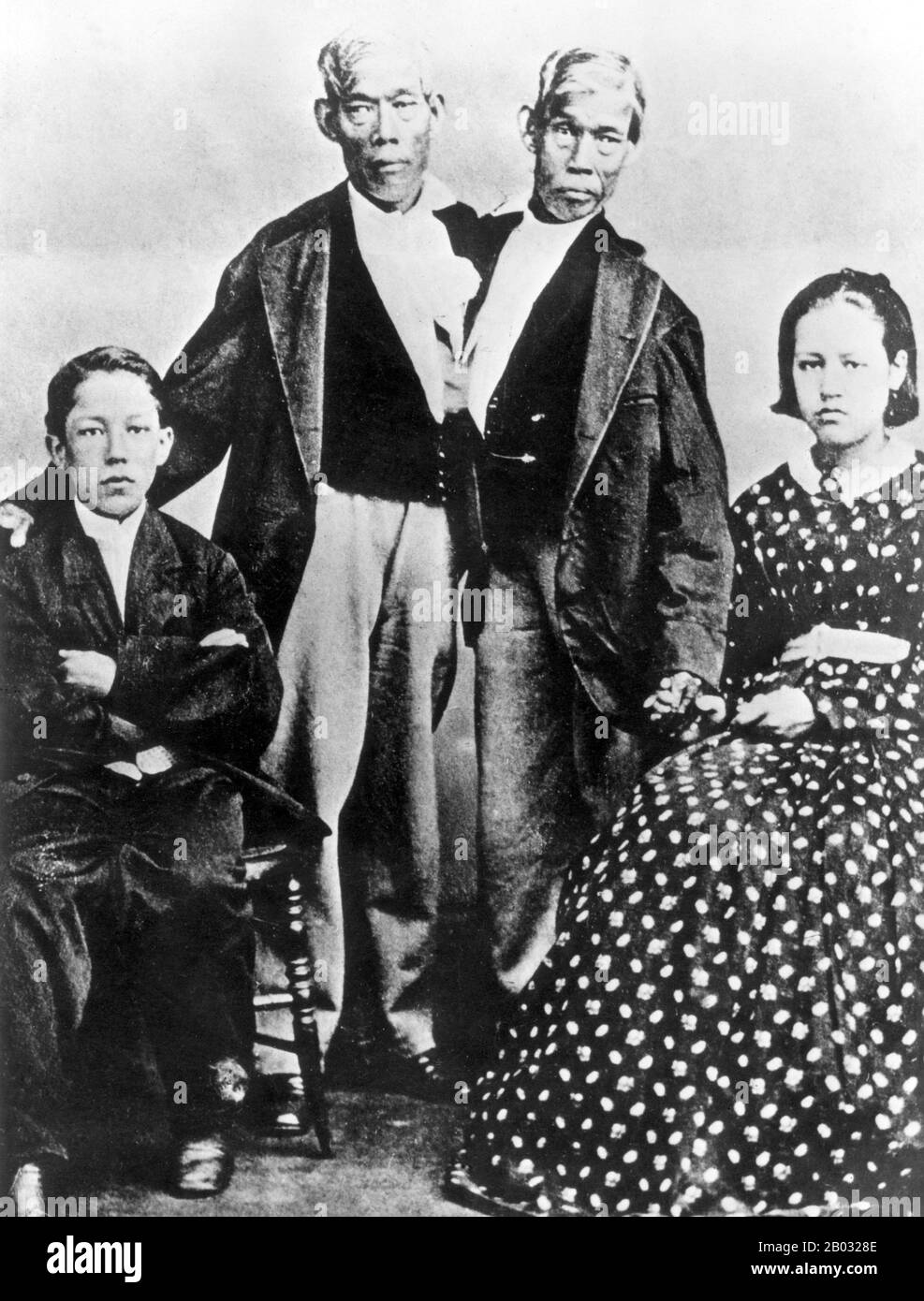 Chang and Eng Bunker (May 11, 1811 – January 17, 1874) were Thai-American conjoined twin brothers whose condition and birthplace became the basis for the term 'Siamese twins'.  The Bunker brothers were born on May 11, 1811, in the province of Samutsongkram, near Bangkok, in the Kingdom of Siam (today's Thailand). Their fisherman father was a Chinese Thai, while their mother was a Chinese Malaysian. Because of their Chinese heritage, they were known locally as the 'Chinese Twins'. The brothers were joined at the sternum by a small piece of cartilage, and though their livers were fused, they wer Stock Photo