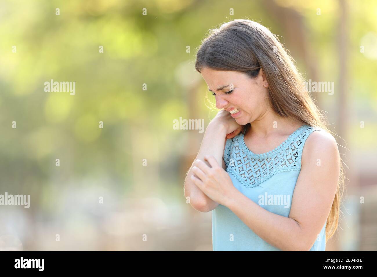 Overwhelmed woman scratching because her arm itches standing in a park in summer season Stock Photo