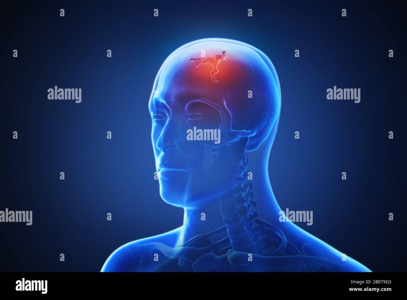 3d rendering of a human body with highlighted in pain 023 Stock Photo ...