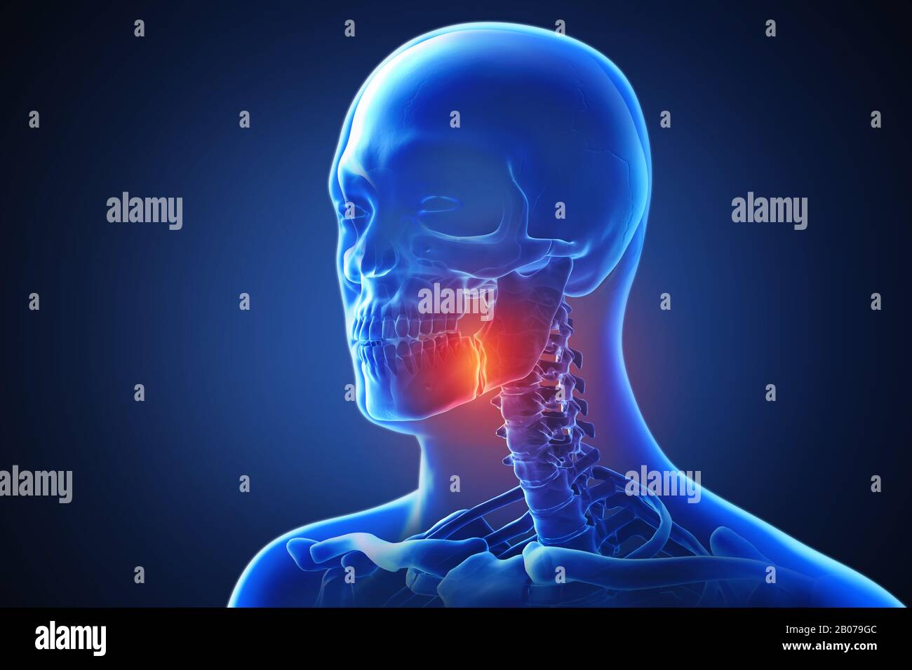 3d rendering of a human body with highlighted in pain 019 Stock Photo ...