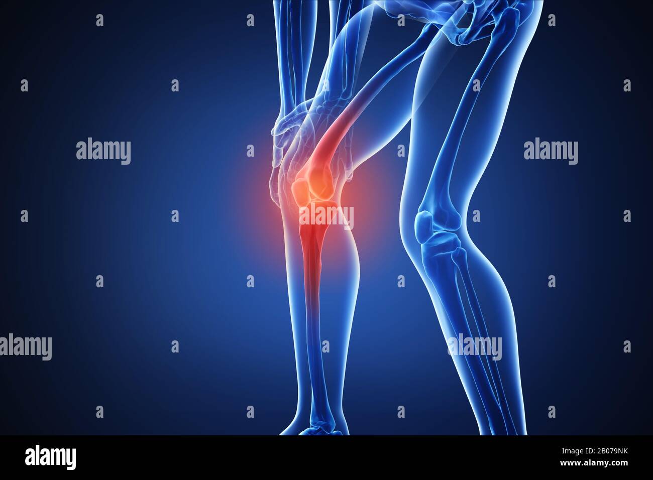 3d rendering of a human body with highlighted in pain 004 Stock Photo ...
