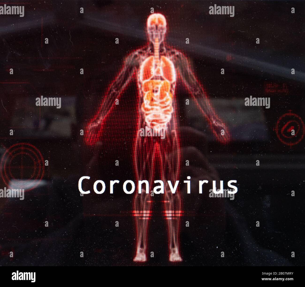 A human skeleton showing illness, the Coronavirus starting from China, family of viruses that cause flu, cold like illness and death, Wuhan, epidemic Stock Photo