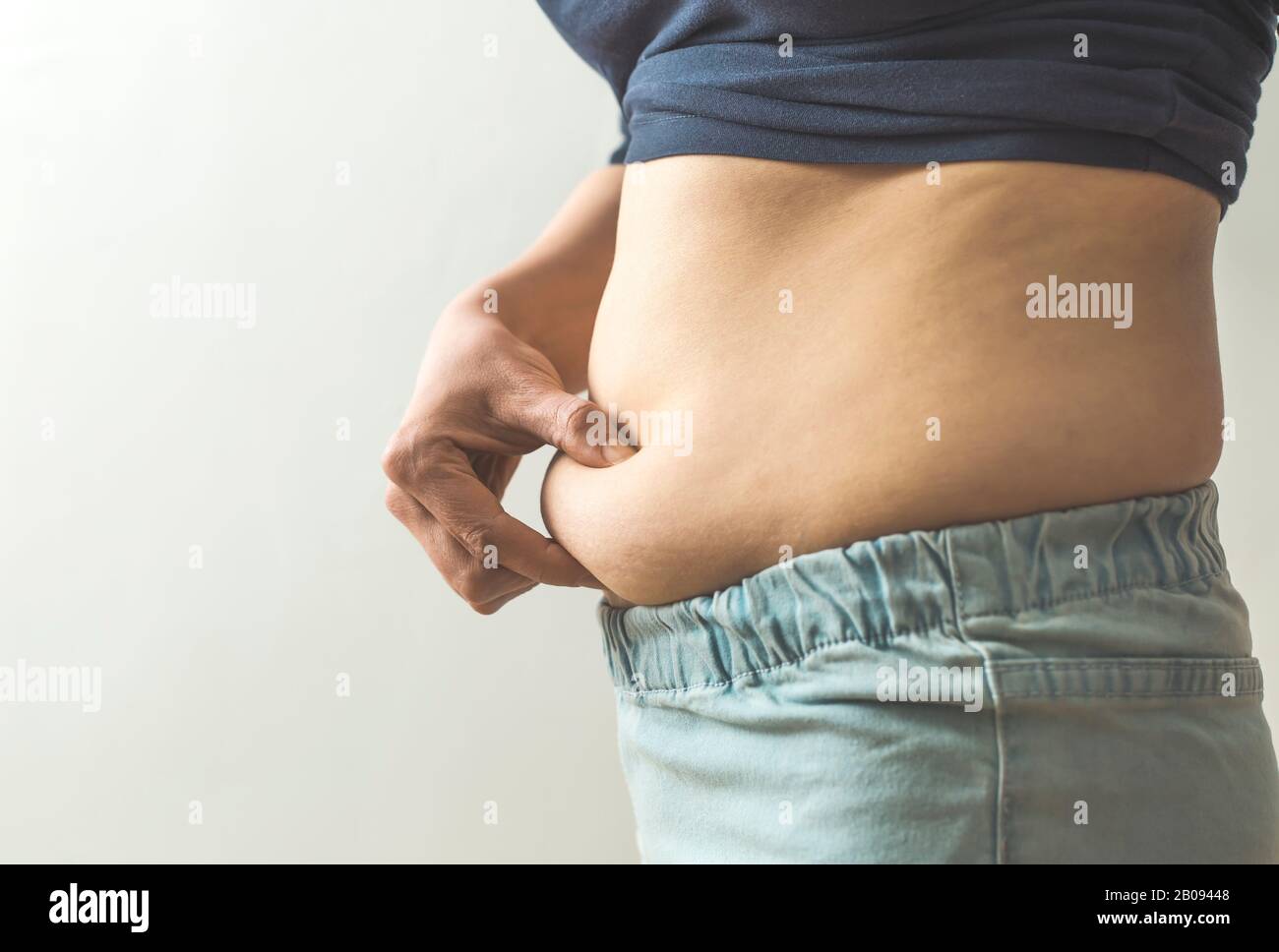 Cellulite on the belly of a woman. Excess weight. Stock Photo