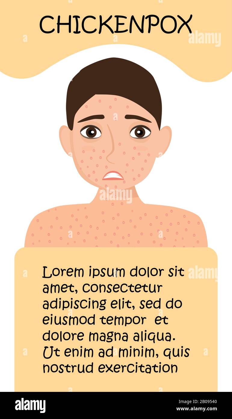 Chickenpox concept vector. Infected human with papules on the skin. Sad human with textbox for medical website. Stock Vector
