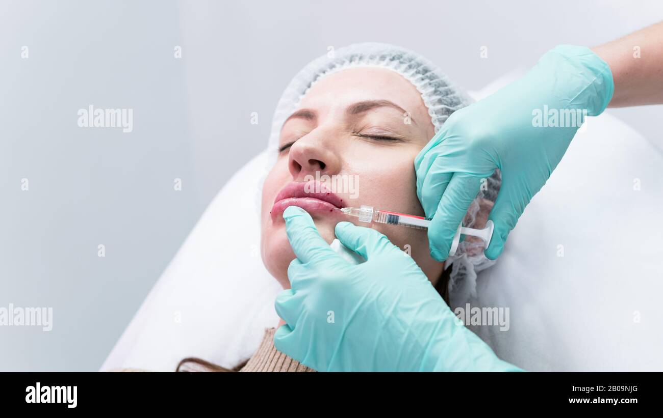 The young beautician doctor preparing to making injection in female lips. The doctor cosmetologist makes lip augmentation procedure. Concept of beauty Stock Photo