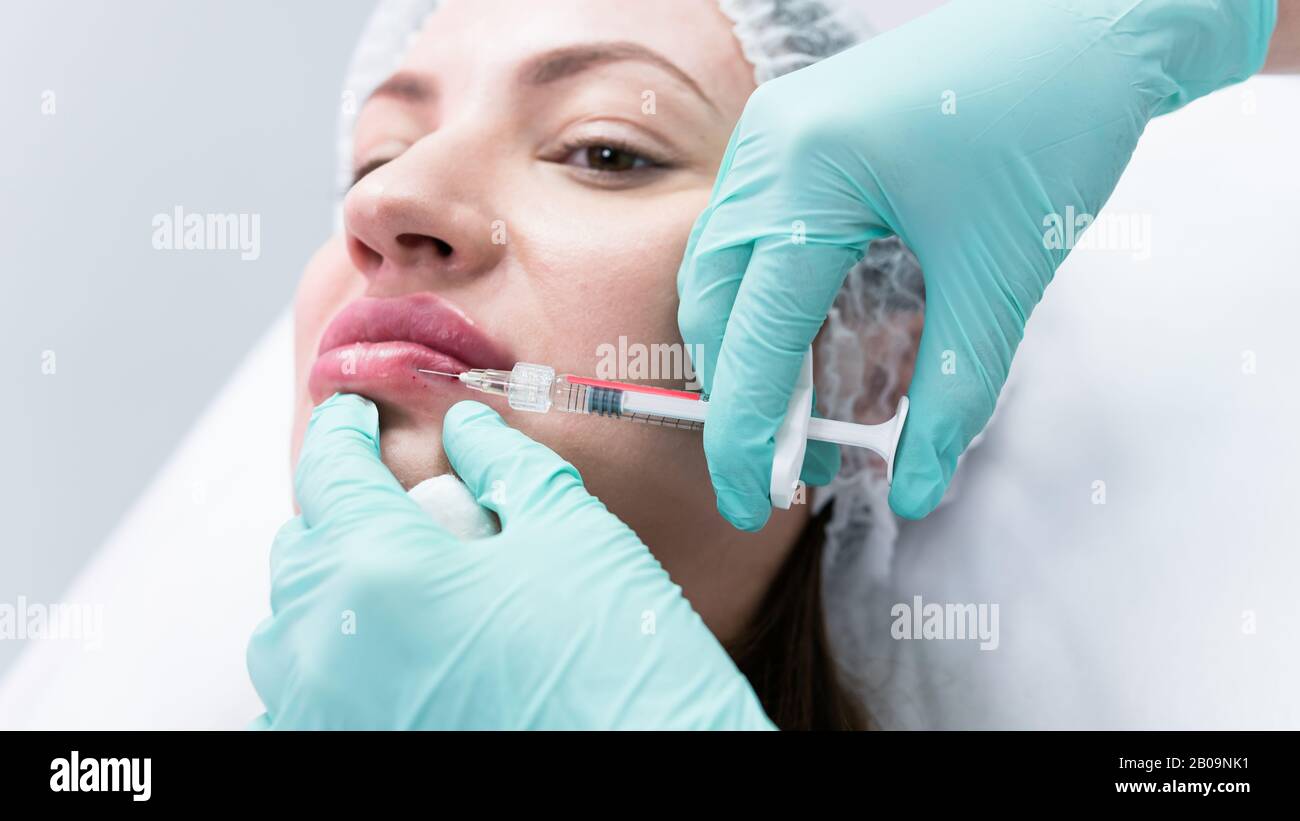 The young beautician doctor preparing to making injection in female lips. The doctor cosmetologist makes lip augmentation procedure. Concept of beauty Stock Photo