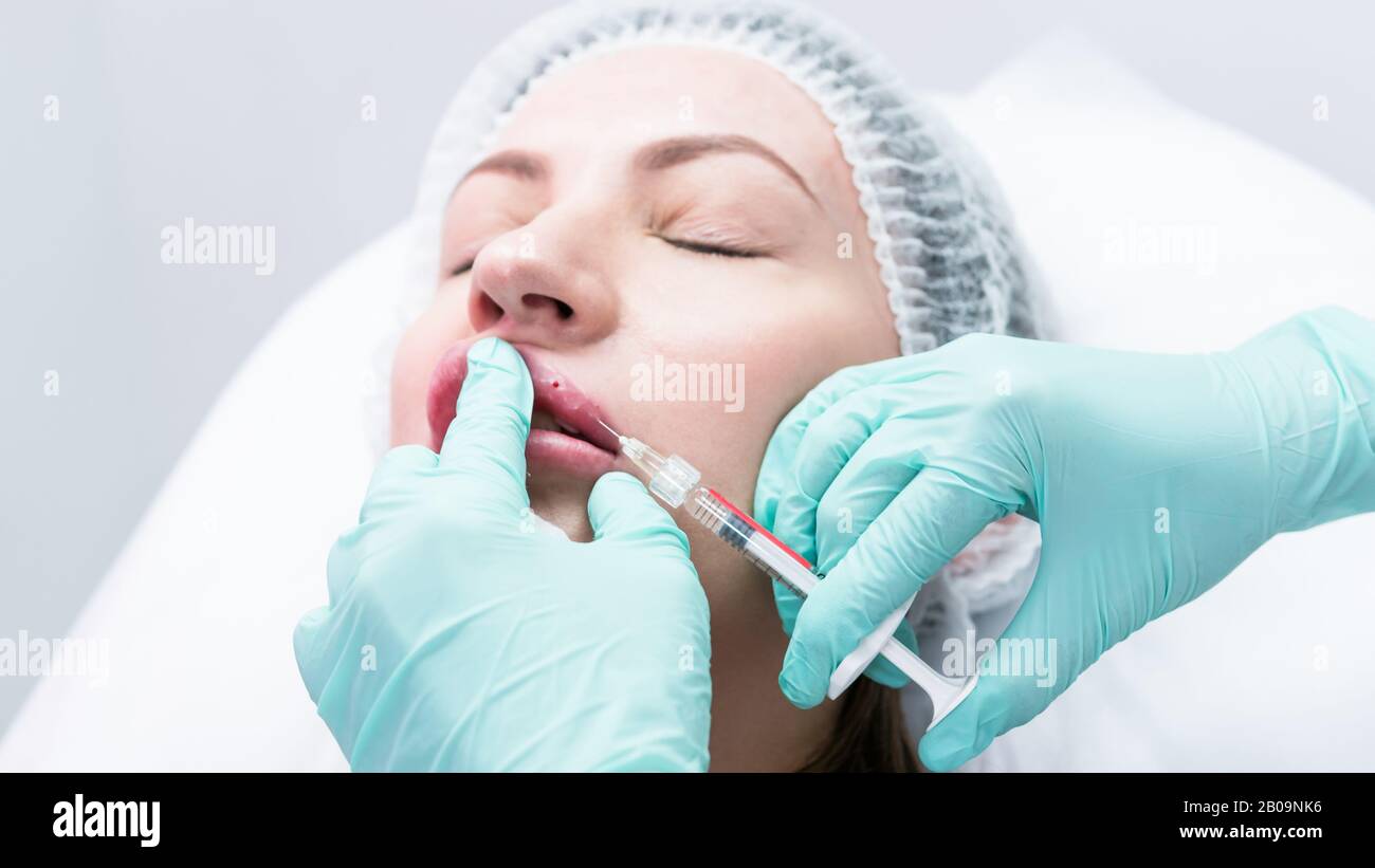 The young beautician doctor preparing to making injection in female lips. The doctor cosmetologist makes lip augmentation procedure. Concept of beauty Stock Photo