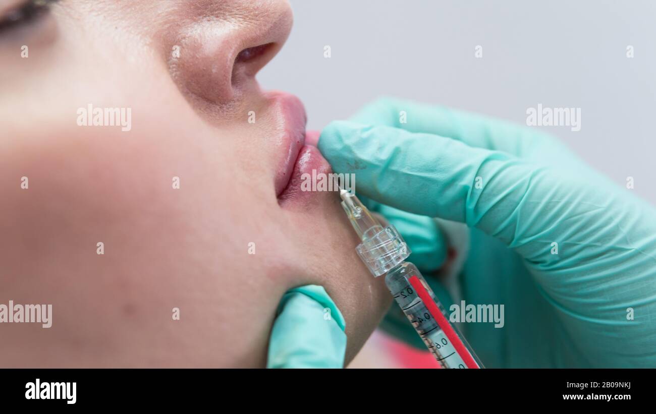 The young beautician doctor preparing to making injection in female lips. The doctor cosmetologist makes lip augmentation procedure. Concept of beauty Stock Photo