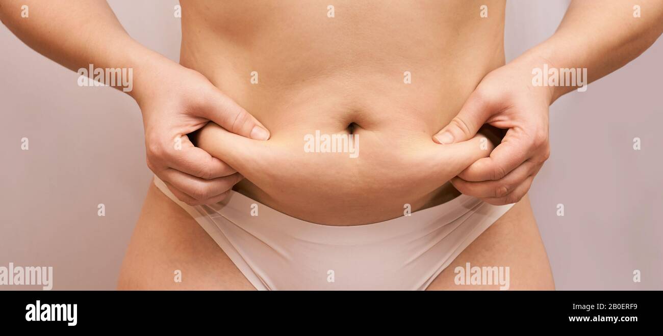 Fat unhealthy woman body. Pinch belly side. Measurement lady procedure. Medicine pinching. Anti cellulite overweight. Stock Photo