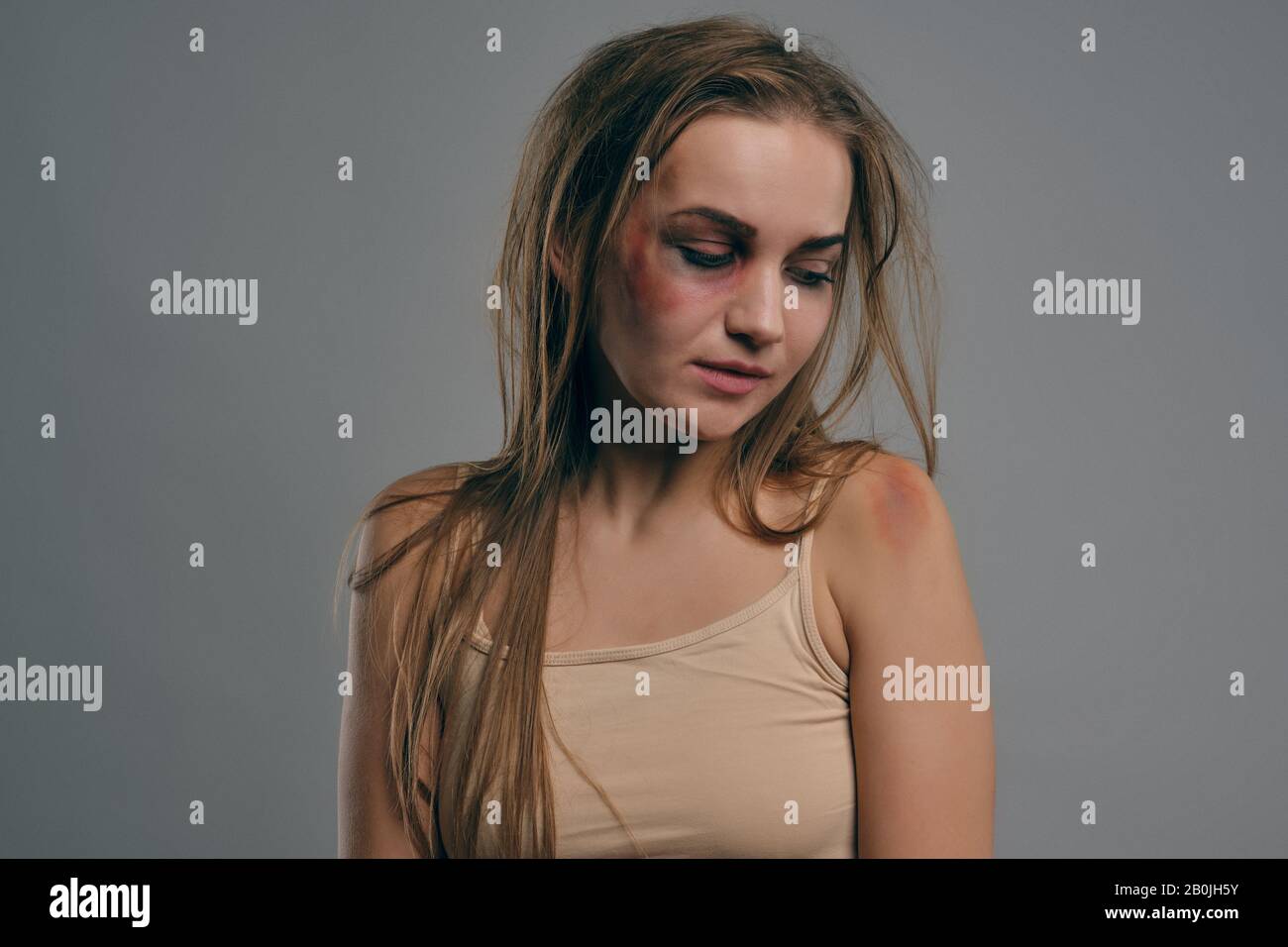 Blonde girl with bruises on her face posing against gray studio