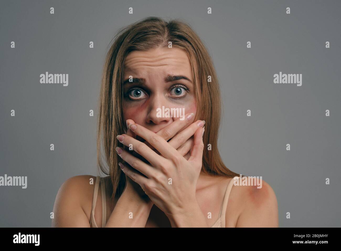 Blonde girl with bruises is covering her face, posing on gray studio