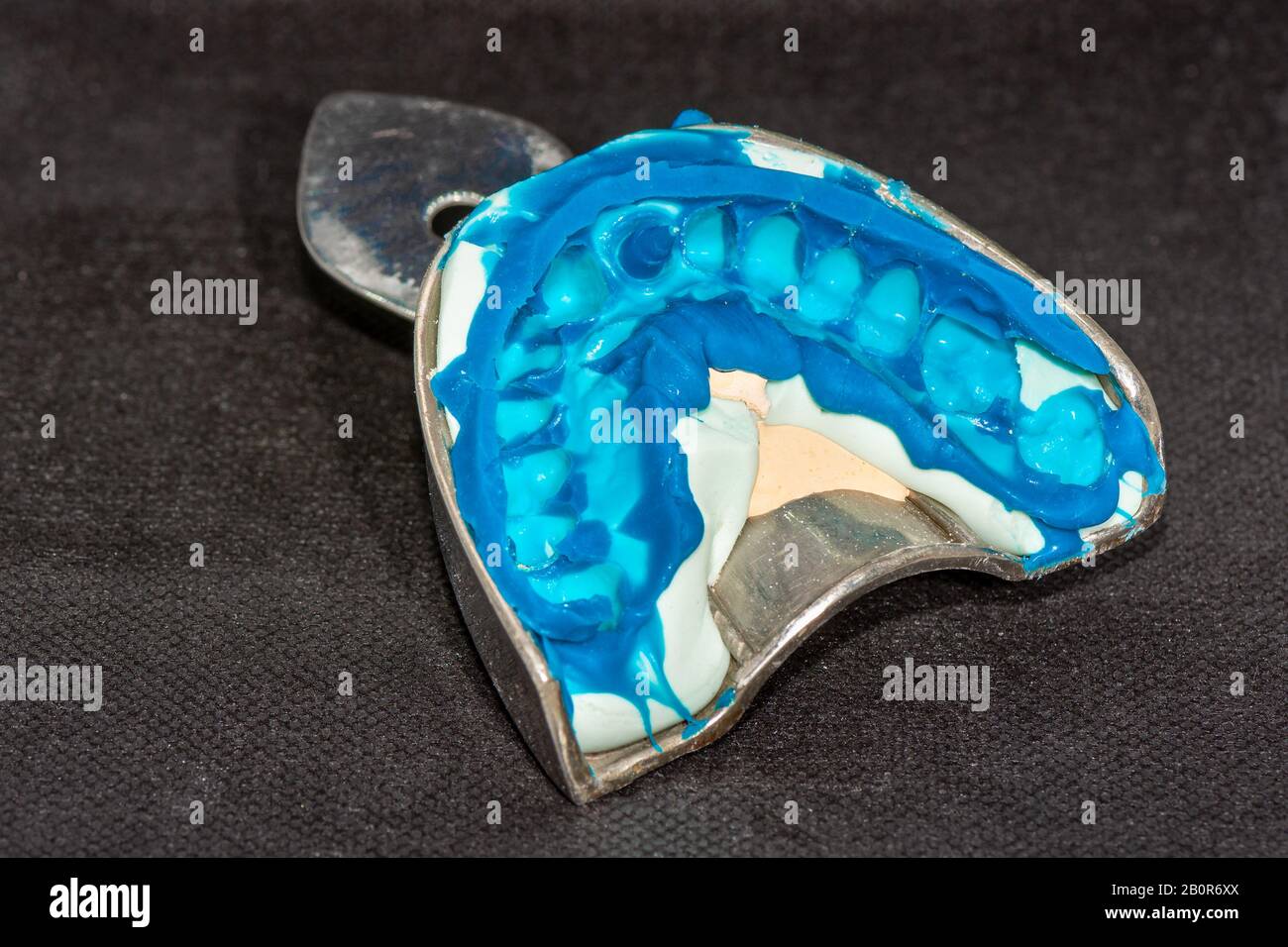 manufacture and installation of dental pins and impressions in dentistry. The process of treating decayed teeth by dentist Stock Photo