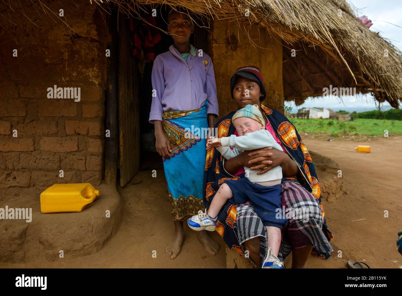 Woman with albino boy sits in front of her straw hut, Mozambique, Africa Stock Photo