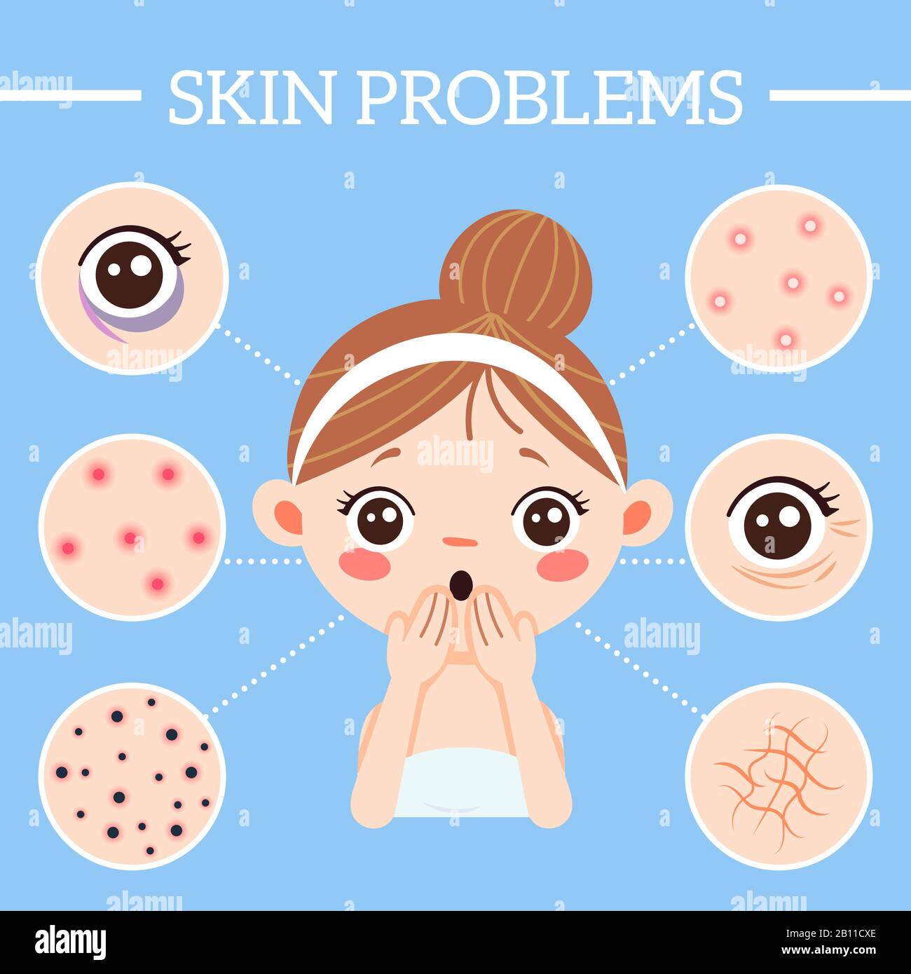 Skin problems infographic. Ages wrinkles problems, blackheads and clogged pores. Acne on woman skin vector illustration Stock Vector