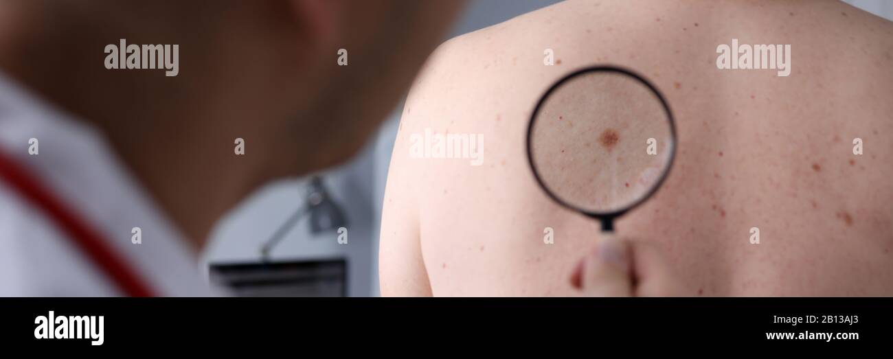 Male doctor look at magnifying glass on patient skin Stock Photo