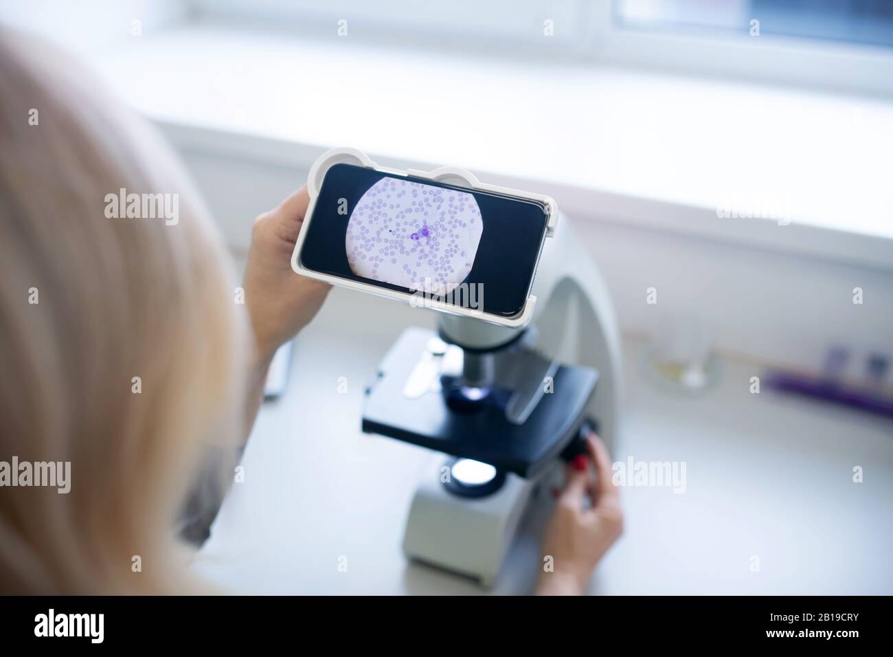 Close up of a test galss with sample for cytological analysis Stock Photo