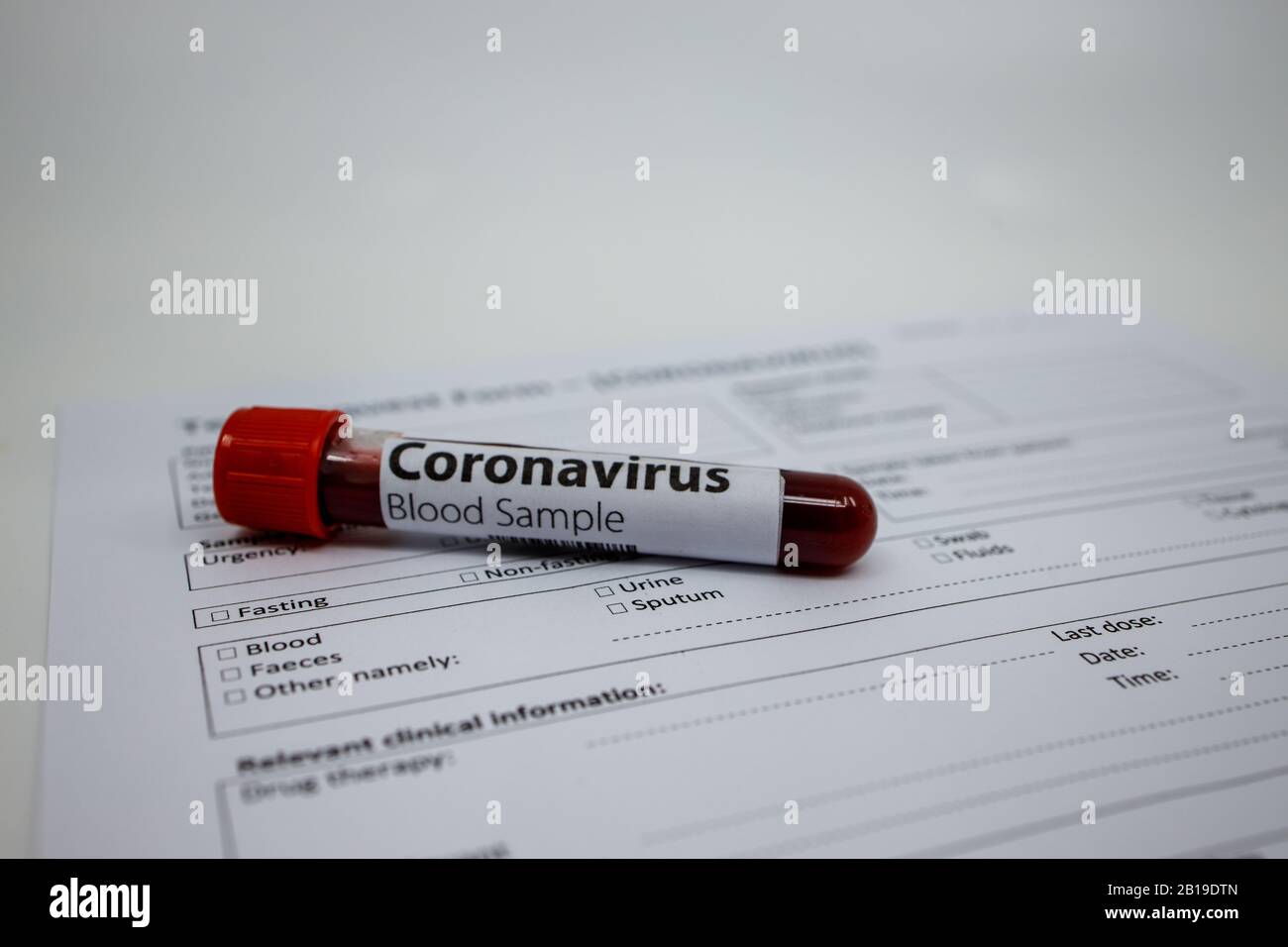 Blood sample for the new rapidly spreading Coronavirus that originated in Wuhan, China. Test tube on an empty blood test request form for covid-19 Stock Photo