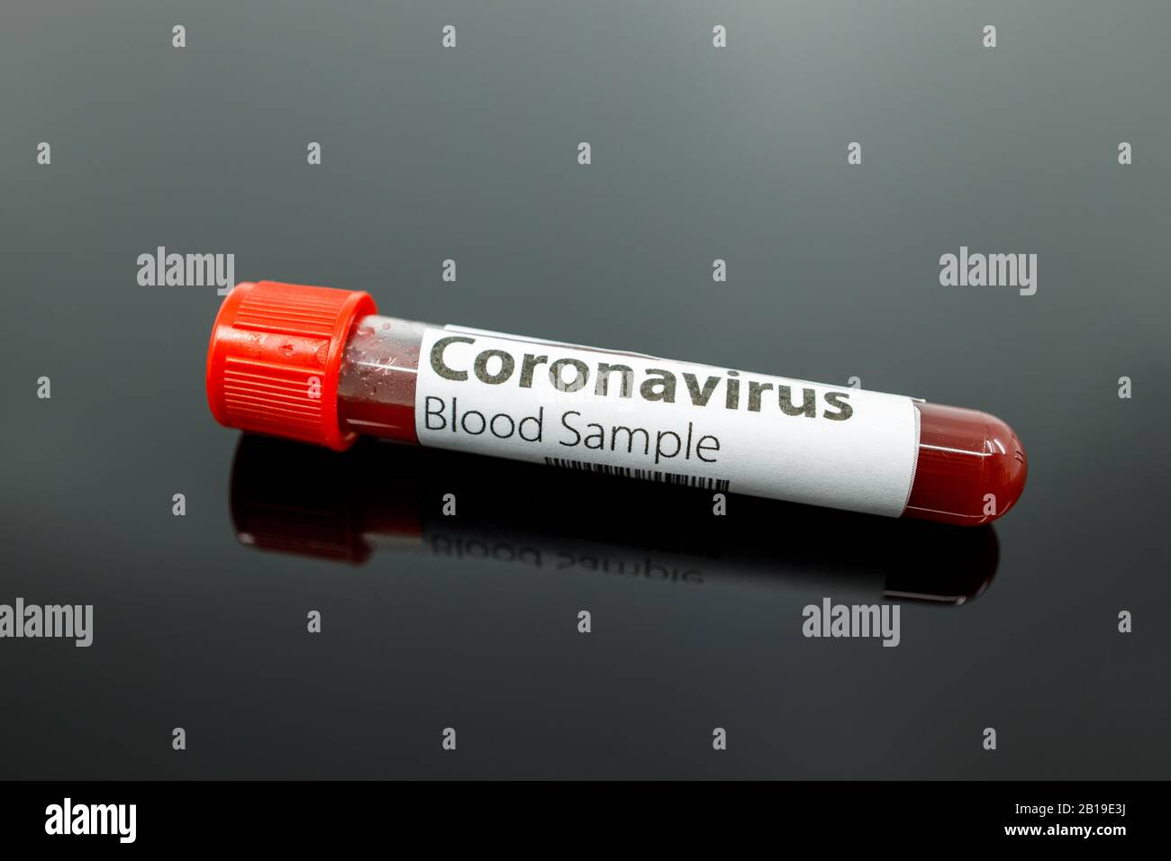 Test tube with blood sample for the new rapidly spreading Coronavirus that originated in Wuhan, China. Coronavirus blood test tube on black background Stock Photo