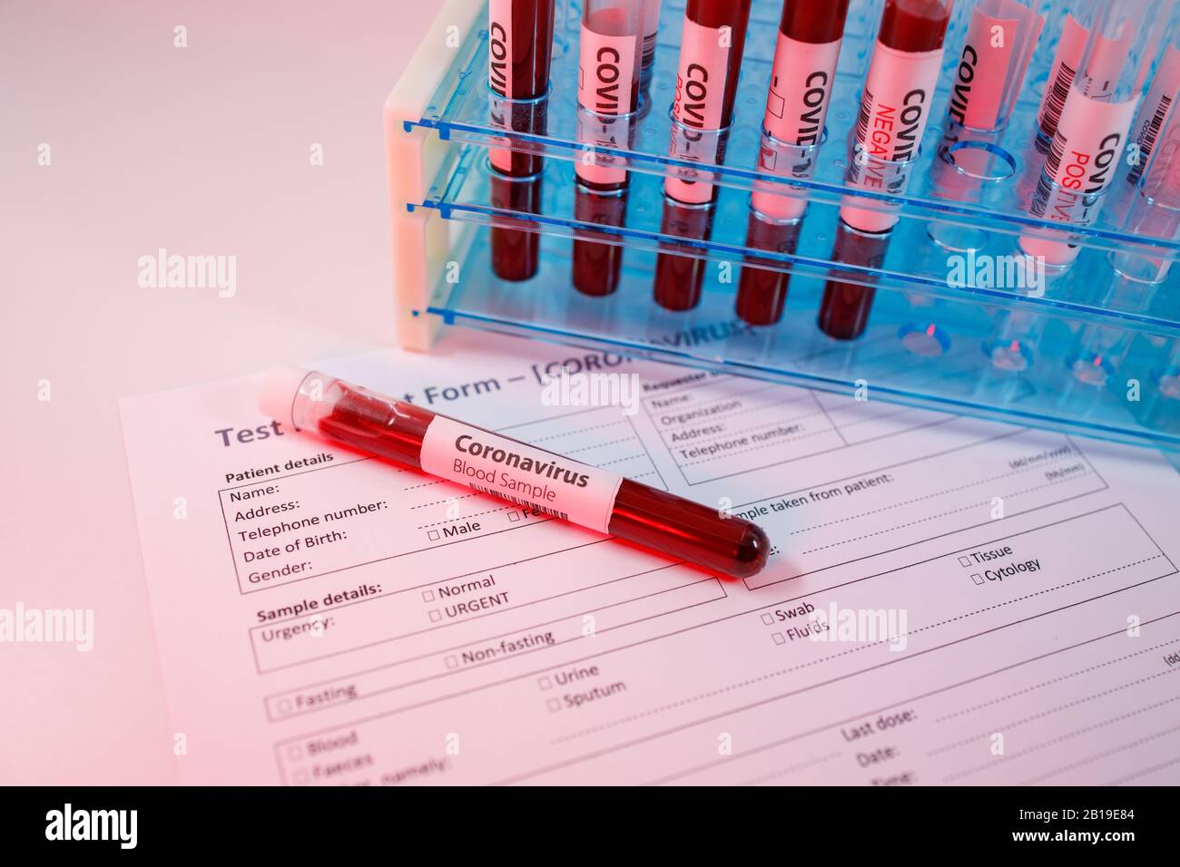 Blood sample for the new rapidly spreading Coronavirus that originated in Wuhan, China. Test tube on an empty test request form for covid-19, test tub Stock Photo